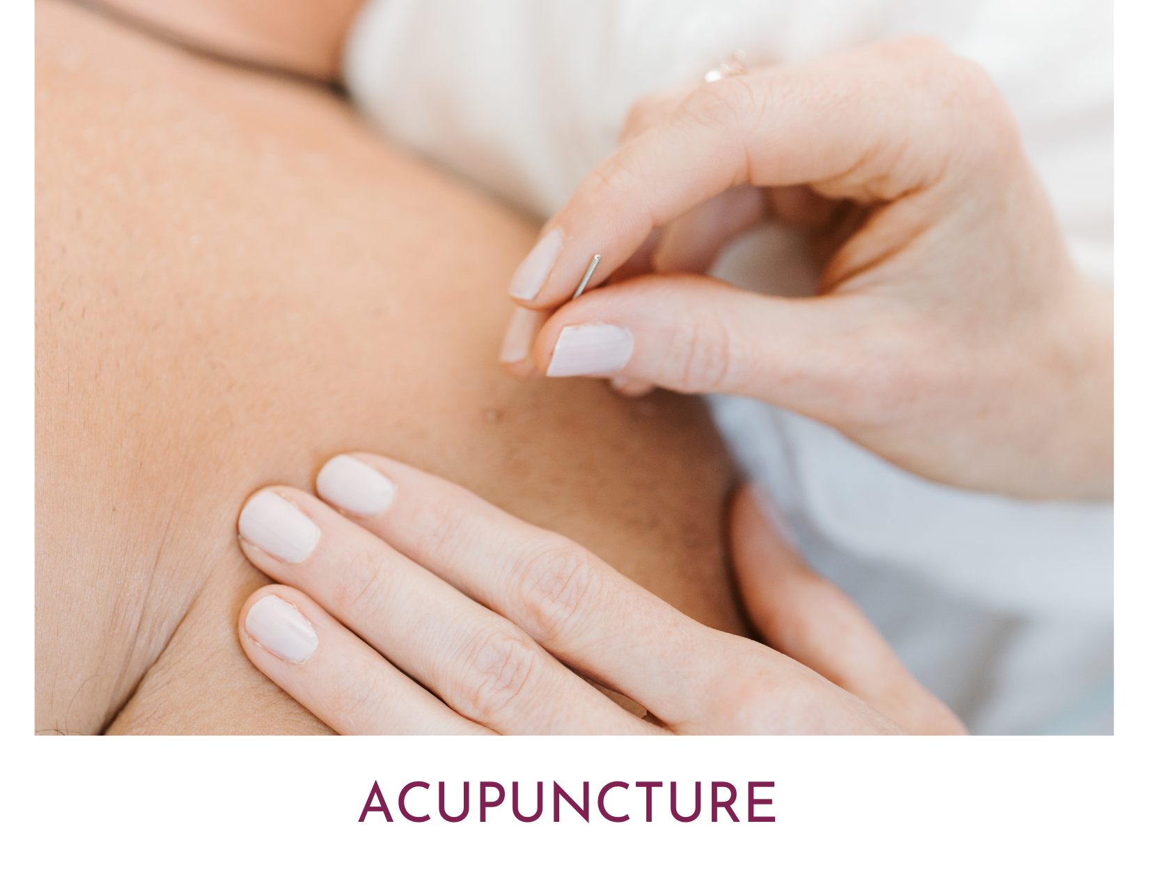 south surrey acupuncture